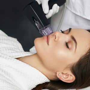 Radiofrecuencia facial symmed