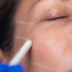 TRATAMIENTO ANTIEDAD REAFIRMANTE (MESOBOOSTER)